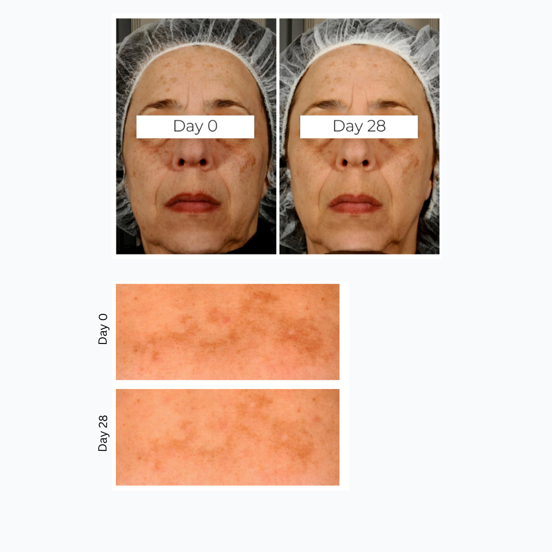 SPOT CORRECTING