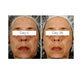 SPOT CORRECTING